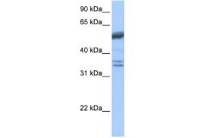 Coilin antibody used at 1 ug/ml to detect target protein. (Coilin Antikörper  (C-Term))