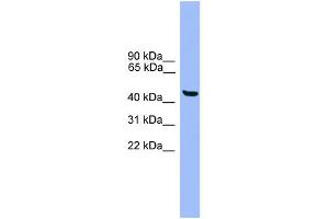WB Suggested Anti-GTF2A1L Antibody Titration: 0. (GTF2A1L Antikörper  (C-Term))