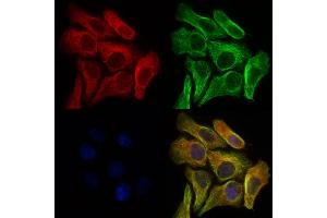 ABIN6254874 and ABIN6276920 staining Hela cells by IF/ICC. (Liver Arginase Antikörper  (C-Term))