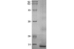 Validation with Western Blot (PTH Protein)