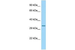 Host: Rabbit Target Name: RPS4Y2 Sample Type: 293T Whole Cell lysates Antibody Dilution: 1. (RPS4Y2 Antikörper  (C-Term))
