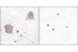 Immunohistochemistry analysis of paraffin-embedded human brain tissue, using mGluR4 Antibody. (Metabotropic Glutamate Receptor 4 Antikörper  (AA 851-900))