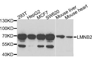 Western blot analysis of extracts of various cell lines, using LMNB2 antibody (ABIN5973877) at 1/1000 dilution. (Lamin B2 Antikörper)