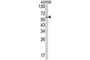 Western blot analysis of SCP2 Antibody (Center) in A2058 cell line lysates (35ug/lane). (SCP2 Antikörper  (Middle Region))