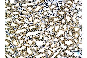 Formalin-fixed and paraffin embedded rat kidney tissue labeled with Anti-Laminin alpha 5 Polyclonal Antibody, Unconjugated (ABIN737451) followed by conjugation to the secondary antibody and DAB staining (Laminin alpha 5 Antikörper  (AA 301-400))