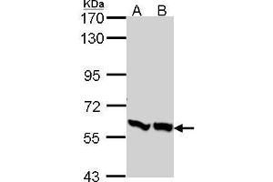 WB Image Sample (30 ug of whole cell lysate) A: A431 , B: H1299 7. (PFKFB3 Antikörper  (C-Term))