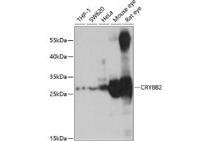 Western blot analysis of extracts of various cell lines, using CRYBB2 antibody (ABIN6130971, ABIN6139077, ABIN6139078 and ABIN6221220) at 1:1000 dilution. (CRYbB2 Antikörper  (AA 1-205))