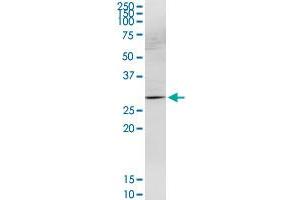 HOXB9 MaxPab rabbit polyclonal antibody. (HOXB9 Antikörper  (AA 1-250))