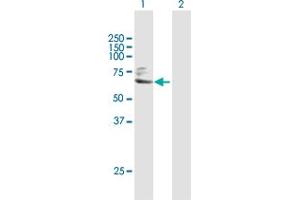 Western Blot analysis of TGM2 expression in transfected 293T cell line by TGM2 MaxPab polyclonal antibody. (Transglutaminase 2 Antikörper  (AA 1-548))