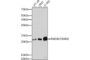 Western blot analysis of extracts of various cell lines, using RAIDD/CRADD Rabbit mAb (ABIN7266106) at 1:3000 dilution. (CRADD Antikörper)