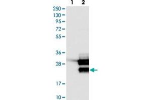 Western blot analysis of Lane 1: Negative control (vector only transfected HEK293T lysate). (TCF21 Antikörper)