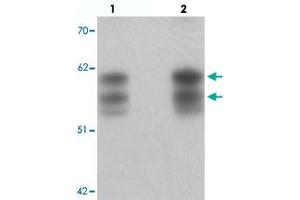 Western blot analysis of NSRP1 in human brain tissue with NSRP1 polyclonal antibody  at (lane 1) 0.