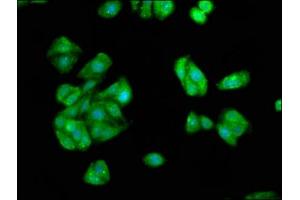 Immunofluorescence staining of HepG2 cells with ABIN7157138 at 1:66, counter-stained with DAPI. (IST1 Antikörper  (AA 172-284))