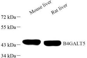 Western blot analysis of B4GALT5 (ABIN7076138) at dilution of 1: 1000 (B4GALT5 Antikörper)