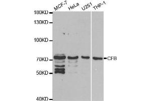 Western blot analysis of extracts of various cell lines, using CFB antibody. (Complement Factor B Antikörper  (AA 80-420))