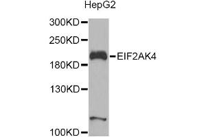 Western blot analysis of extracts of HepG2 cells, using EIF2AK4 Antibody. (GCN2 Antikörper)