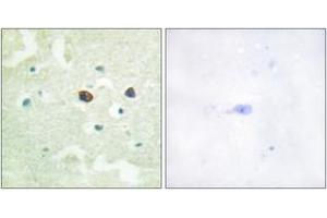Immunohistochemistry analysis of paraffin-embedded human brain, using PTP1B (Phospho-Ser50) Antibody. (PTPN1 Antikörper  (pSer50))