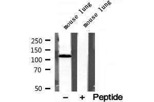 Western blot analysis of extracts of mouse lung tissue, using OGDH antibody. (alpha KGDHC Antikörper  (N-Term))