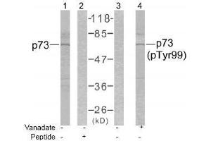 Image no. 1 for anti-Tumor Protein P73 (TP73) (Tyr99) antibody (ABIN197232) (Tumor Protein p73 Antikörper  (Tyr99))