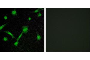 P-peptide - +Immunofluorescence analysis of LOVO cells, using IκB-α (Phospho-Ser32/Ser36) antibody.