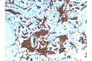 Formalin-fixed, paraffin-embedded human Placenta stained with Glycophorin A Recombinant Rabbit Monoclonal Antibody (GYPA/3219R). (Rekombinanter CD235a/GYPA Antikörper)