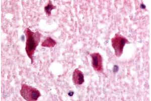 Anti-NR2E1 antibody  ABIN1049135 IHC staining of human brain, neurons and glia.
