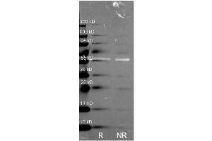 Catalase antibody was used to detect Catalase under reducing (R) and non-reducing (NR) conditions.