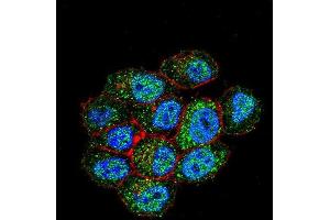 Confocal immunofluorescent analysis of TSPYL6 Antibody (Center) with Hela cell followed by Alexa Fluor 488-conjugated goat anti-rabbit lgG (green). (TSPY-Like 6 Antikörper  (Middle Region))