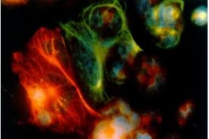 Image no. 1 for anti-Keratin 18 (KRT18) antibody (ABIN335330) (Cytokeratin 18 Antikörper)
