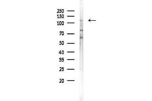 Western blot analysis of lysates from COLO205 cells, using SEMD Antibody at 1/1000 dilution.