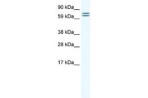 WB Suggested Anti-CES6 Antibody Titration:  1. (CES4A Antikörper  (Middle Region))