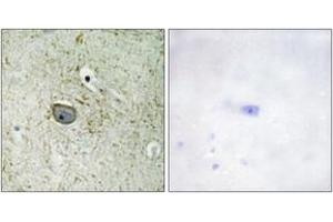 Immunohistochemistry analysis of paraffin-embedded human brain tissue, using PDGFR alpha (Ab-762) Antibody. (PDGFRA Antikörper  (AA 731-780))