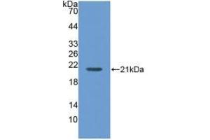 Western blot analysis of recombinant Human MGA. (AGLU Antikörper  (AA 213-392))