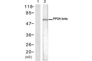 Western blot analysis of extracts from 293 cells using PP2A-beta antibody (E021404, Lane 1 and 2). (PPP2CB Antikörper)