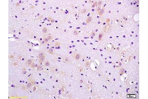 Formalin-fixed and paraffin embedded rat brain labeled with Anti-CaIPLA2/PLA2G6 Polyclonal Antibody, Unconjugated (ABIN720281) at 1:200 followed by conjugation to the secondary antibody and DAB staining. (PLA2G6 Antikörper  (AA 651-750))