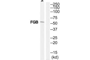 Western Blotting (WB) image for anti-Fibrinogen beta Chain (FGB) (C-Term) antibody (ABIN1852788) (Fibrinogen beta Chain Antikörper  (C-Term))