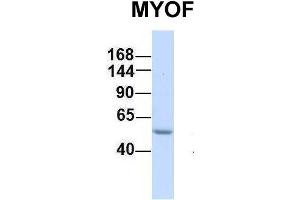 Host:  Rabbit  Target Name:  MYOF  Sample Type:  Human Fetal Liver  Antibody Dilution:  1.