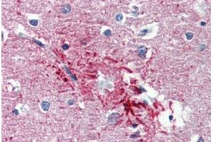 Human Brain, Cortex, Senile Plaque (formalin-fixed, paraffin-embedded) stained with HMGN1 antibody ABIN462182 followed by biotinylated goat anti-rabbit IgG secondary antibody ABIN481713, alkaline phosphatase-streptavidin and chromogen. (HMGN1 Antikörper  (AA 36-85))