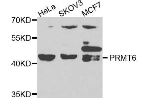 Western blot analysis of extracts of various cell lines, using PRMT6 antibody. (PRMT6 Antikörper)