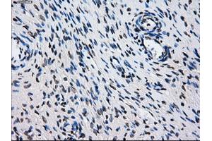 Immunohistochemical staining of paraffin-embedded colon tissue using anti-L1CAMmouse monoclonal antibody. (L1CAM Antikörper)