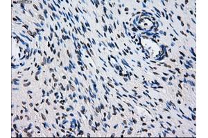 Immunohistochemical staining of paraffin-embedded colon tissue using anti-L1CAMmouse monoclonal antibody.