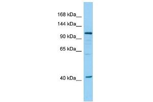 Host: Rabbit Target Name: DHTKD1 Sample Type: 293T Whole Cell lysates Antibody Dilution: 1.