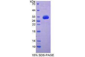 SDS-PAGE analysis of Human GDF11 Protein.