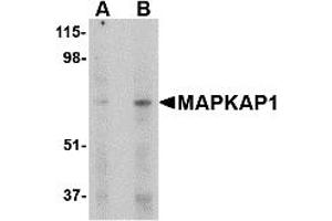 Western Blotting (WB) image for anti-Mitogen-Activated Protein Kinase Associated Protein 1 (MAPKAP1) (Middle Region) antibody (ABIN1030995)