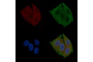ABIN6260435 and ABIN6272263 staining Hela cells(24h of starvation treatment) by IF/ICC. (CaMK2 beta/gamma Antikörper  (C-Term))