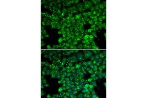 Immunofluorescence analysis of U20S cell using LYZL6 antibody. (LYZL6 Antikörper  (AA 20-148))
