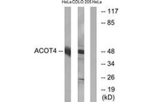 Western blot analysis of extracts from HeLa/COLO cells, using ACOT4 Antibody. (ACOT4 Antikörper  (AA 361-410))