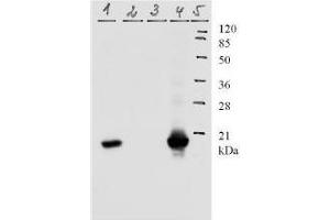 Western Blotting (WB) image for anti-Human Papilloma Virus 11 E7 (HPV-11 E7) (AA 1-35), (N-Term) antibody (ABIN781776) (Human Papilloma Virus 11 E7 (HPV-11 E7) (AA 1-35), (N-Term) Antikörper)