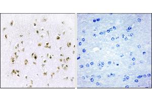 Immunohistochemistry analysis of paraffin-embedded human brain tissue, using HMG17 antibody. (HMGN2 Antikörper)