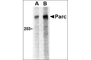 Western blot analysis of PARC in Daudi lysate with this product at (A) 1 and (B) 2 μg/ml. (CUL9 Antikörper  (C-Term))